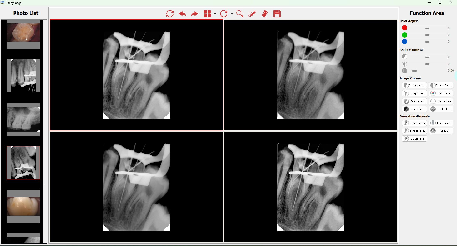 Handy tandlæge billedbehandlingssoftware (12)