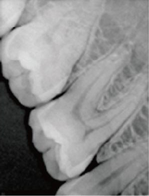 Хэнди стоматолог күзаллау белән идарә итү Softwae (3)