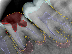 1.Handy AI Disease Detection