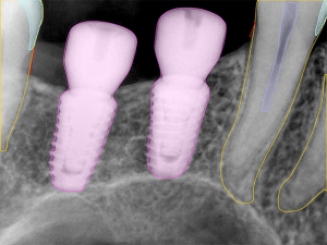 3.Handy AI Restoration Analysis