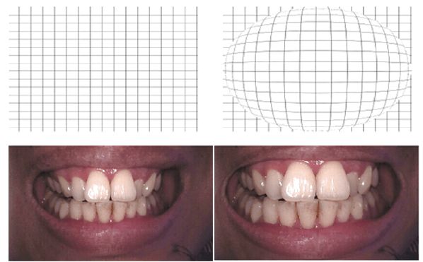 Intraoral Camera HDI-712D (6)