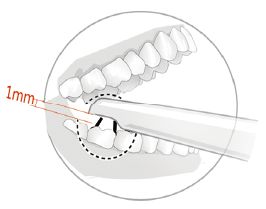 Intraoral Camera HDI-712D (7)