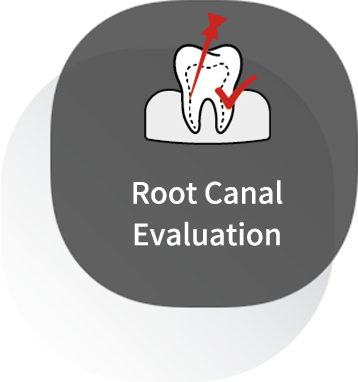 Root Canal Evaluation